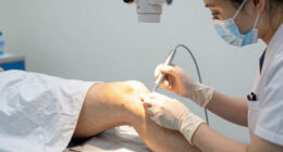 Not Ready for a Knee Replacement? A Minimally Invasive Procedure May Ease Chronic Pain Without Joint Replacement