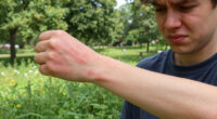 Rayden Vollrath Pokeweed Allergic Reaction